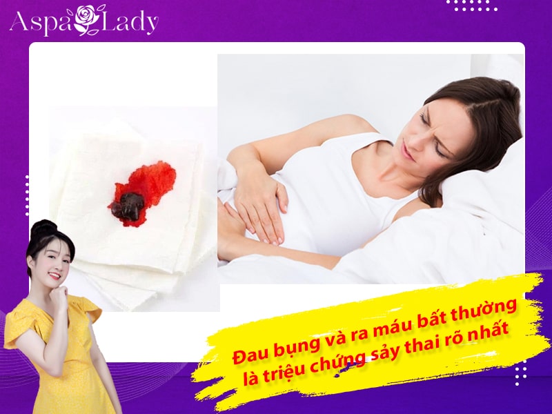 Đau bụng và ra máu bất thường là triệu chứng sảy thai rõ nhất