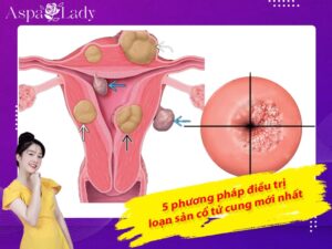 5 phương pháp điều trị loạn sản cổ tử cung mới nhất