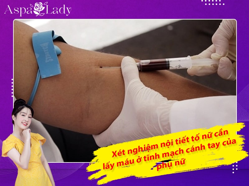 Xét nghiệm nội tiết tố nữ bằng cách lấy máu ở tĩnh mạch cánh tay của phụ nữ