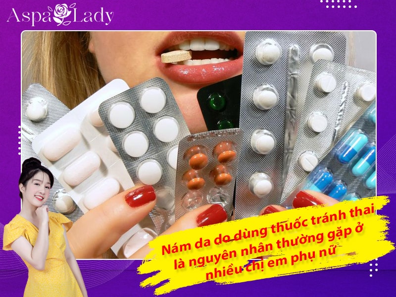 Nám da do dùng thuốc tránh thai là nguyên nhân thường gặp ở nhiều chị em phụ nữ