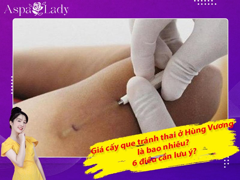 Giá cấy que tránh thai ở Hùng Vương là bao nhiêu? 6 điều cần lưu ý?