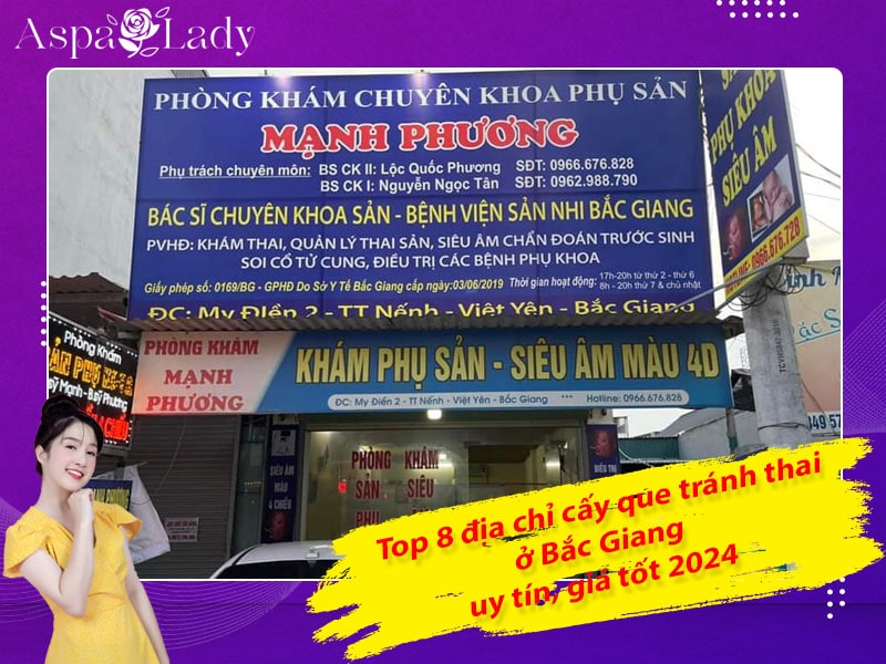 Top 8 địa chỉ cấy que tránh thai ở Bắc Giang uy tín, giá tốt 2024