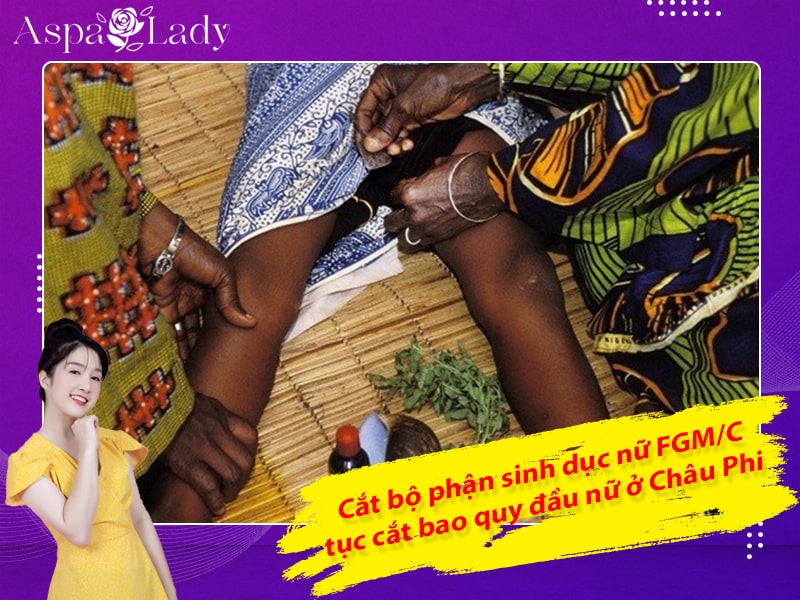 Cắt bộ phận sinh dục nữ FGM/C - tục cắt bao quy đầu nữ ở Châu Phi