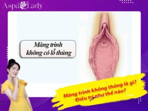 Màng trinh không thủng là gì? Điều trị như thế nào?