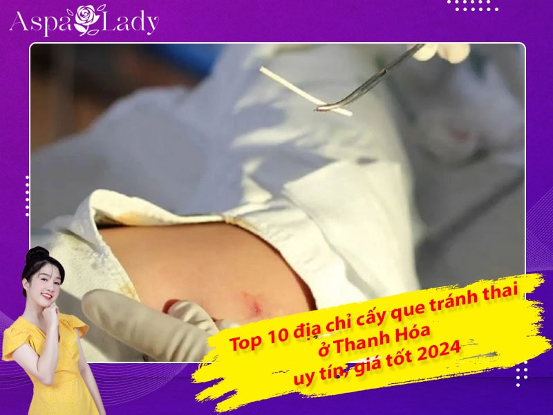 Top 10 địa chỉ cấy que tránh thai ở Thanh Hóa uy tín, giá tốt 2024