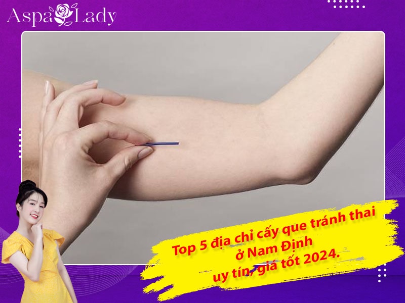 Top 5 địa chỉ cấy que tránh thai ở Nam Định uy tín, giá tốt 2024.