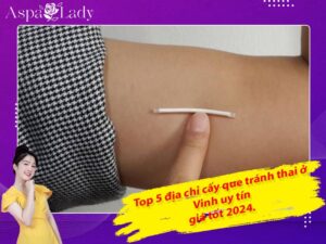 Top 5 địa chỉ cấy que tránh thai ở Vinh uy tín, giá tốt 2024.