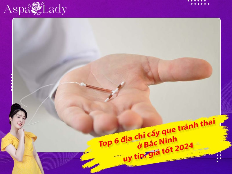 Top 6 địa chỉ cấy que tránh thai ở Bắc Ninh uy tín, giá tốt 2024